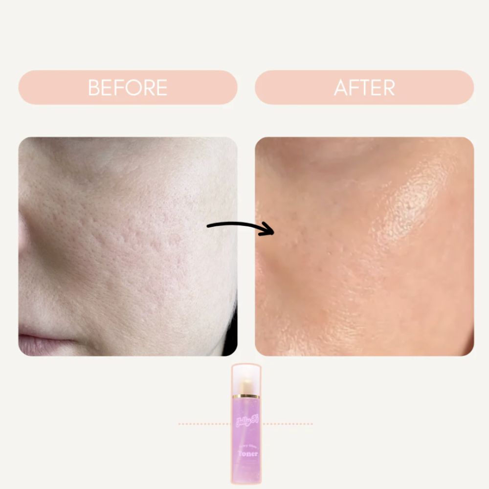 Jelly Ko Dewy Glaze Toner 155ml